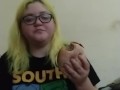 Amputee eats burger