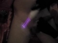 PENIS COCK DICK High Frequency treatment massage