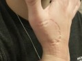 Self Biting with Perfect Teeth Impressions