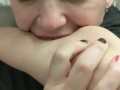 Self Biting with Perfect Teeth Impressions