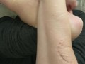 Self Biting with Perfect Teeth Impressions