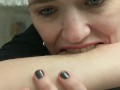 Self Biting with Perfect Teeth Impressions