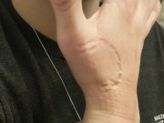 Self Biting with Perfect Teeth Impressions