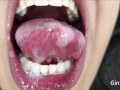 Mouth, teeth, vore, spit and tongue fetish of Jan and Feb (demos)