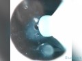 CAMERA INSIDE VAGINA AFTER INTERNAL CREAMPIE - ส่องกล้องดูอสุจิในช่องคลอด