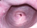 Cervix close up [4k]