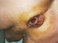 huge vegetable insertion - anal gape close up