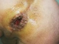 huge vegetable insertion - anal gape close up