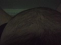 my belly is moving during contractions