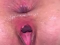 Worn out holes from a gloryhole