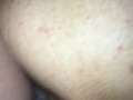 Cock ring cock in pussy
