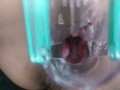 Masturbating with a speculum