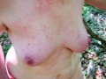 Very hard tit flogging outdoor - completely naked