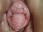 Loose pumped pussy prolapse pushing out