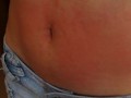 I show my red belly from the torture I received from the red belly game, my stomach inflamed