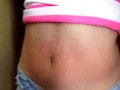 I show my red belly from the torture I received from the red belly game, my stomach inflamed