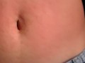 I show my red belly from the torture I received from the red belly game, my stomach inflamed