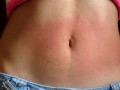 I show my red belly from the torture I received from the red belly game, my stomach inflamed
