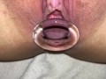 Pussy plug expansion training