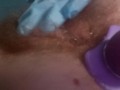 Tiny asshole is stretched with fingers and toys by naughty nurse 