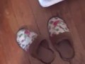 @tici_feet IG tici feet tici_feet walking, black toenails