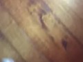 @tici_feet IG tici feet tici_feet walking, black toenails