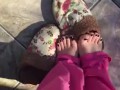 @tici_feet IG tici feet tici_feet walking, black toenails