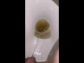 Week 29 Pee diary