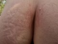 Voyeur Slut On All Fours in Park is Fingered Until She Cums