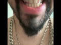 Tongue ASMR sticking out with teeth! Suck my tongue please 