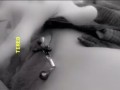 Clit clamp
