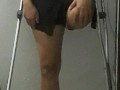 amputated stump massage