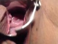 Speculum in my pussy and cervix show close up