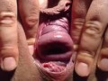 Speculum in my pussy and cervix show close up