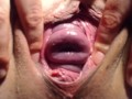 Speculum in my pussy and cervix show close up