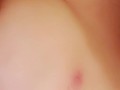 A Little Biting