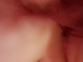A Little Biting