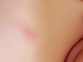A Little Biting