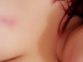 A Little Biting