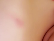 A Little Biting