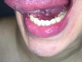 Long tongue, dense spit and ... (Short version)