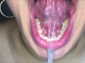 Long tongue, dense spit and ... (Short version)