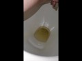 Week 45 Pee diary