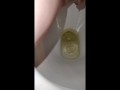Week 45 Pee diary