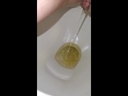 Week 45 Pee diary