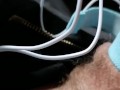 Milking cum by Electro Urethral Stimulation