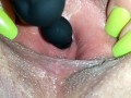 Step sister wanted me to put anal beads in her peehole