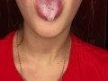 Messy drooling