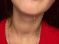 Messy drooling