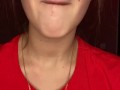 Messy drooling